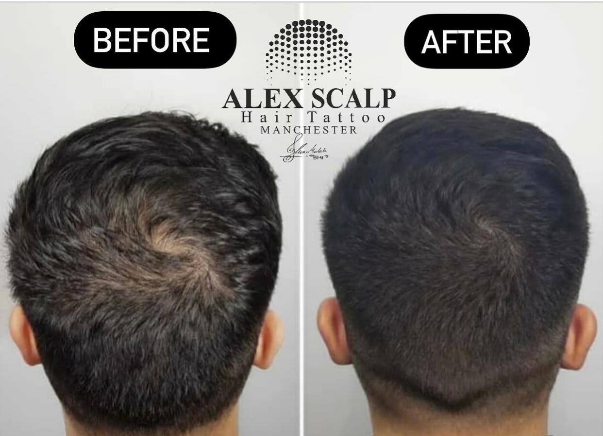 SMP healed result example 1