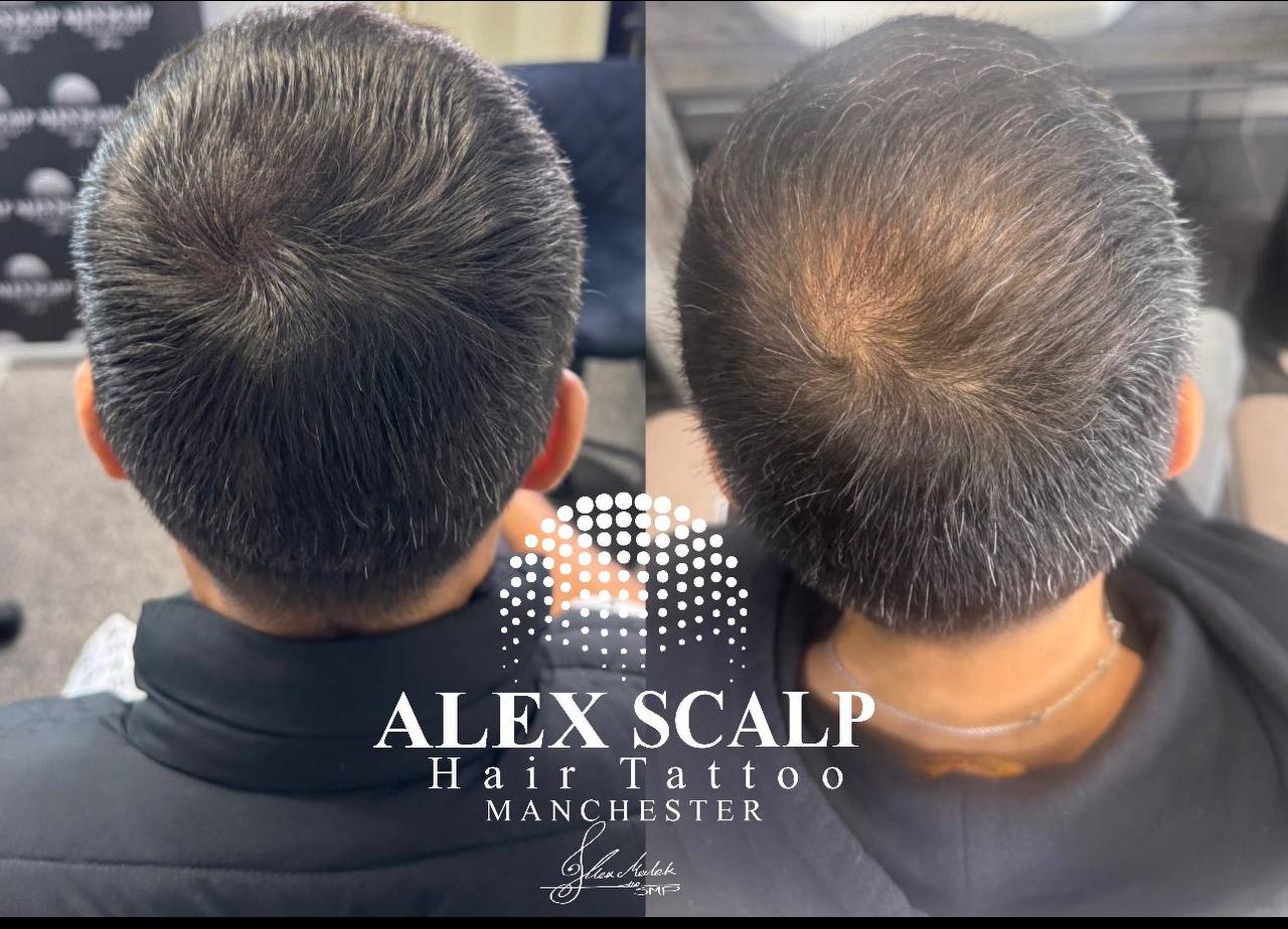 SMP healed result example 10