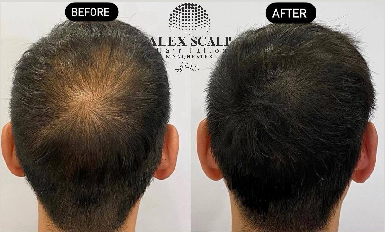 SMP healed result example 8